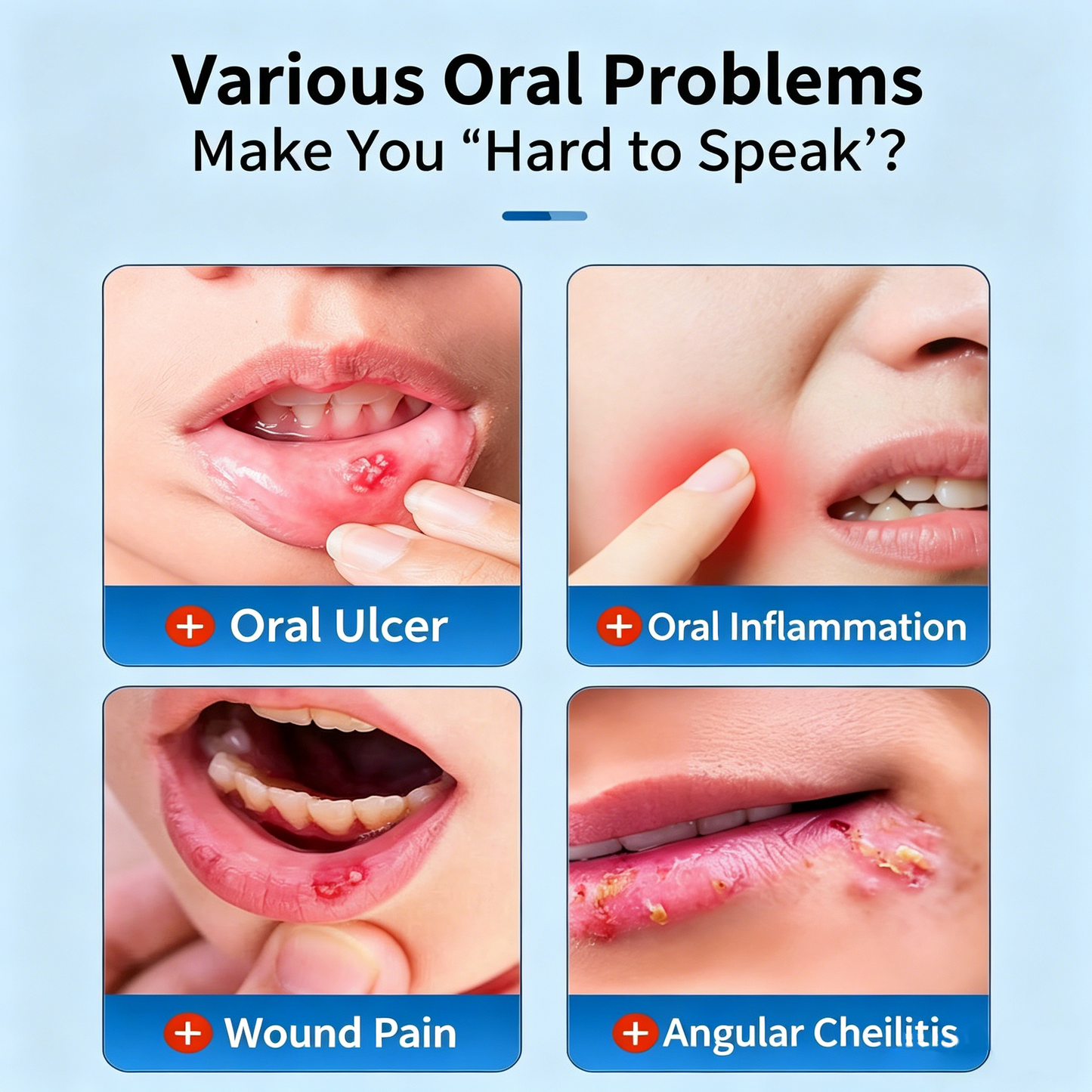 Medical Oral Repair Gel, Fast Relief for Mouth Ulcer & Inflammation