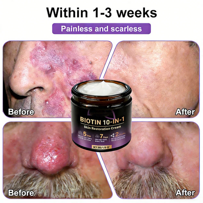 Biotin 10-in-1 Skin Restoration Cream