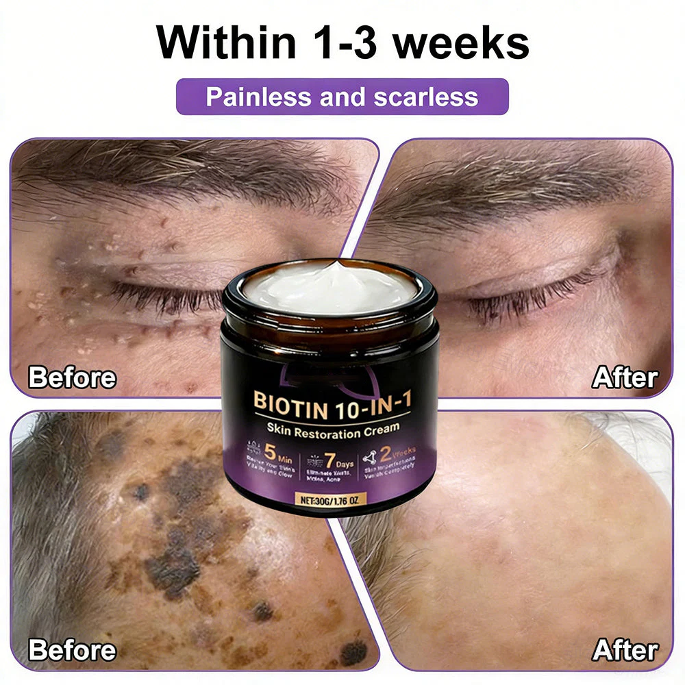 Biotin 10-in-1 Skin Restoration Cream