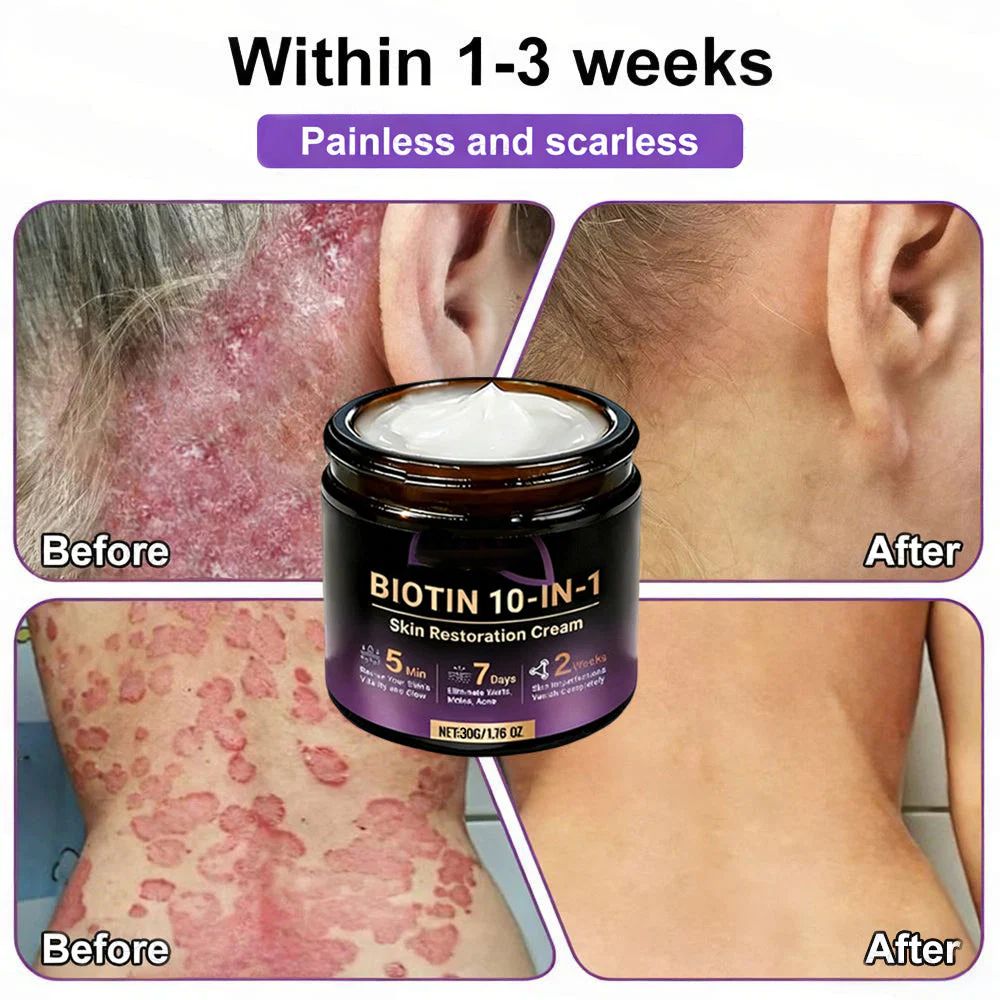 Biotin 10-in-1 Skin Restoration Cream