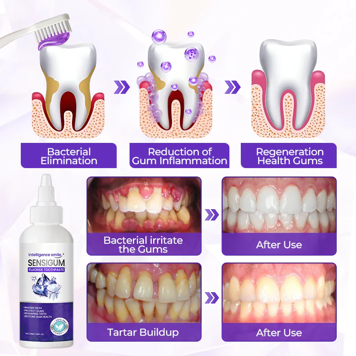 Fluoride Toothpaste  for Oral Care