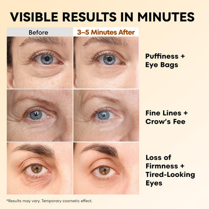 Instant Firm Eye Tightener
