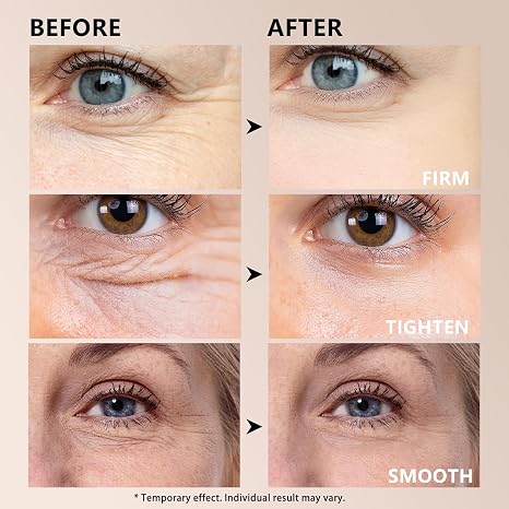 Instant Firm Eye Tightener