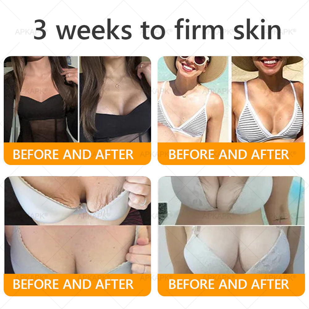 𝐀𝐏𝐊𝐀𝐏® 𝐁𝐞𝐞 𝐯𝐞𝐧𝐨𝐦 𝐒𝐤𝐢𝐧 𝐑𝐞𝐬𝐭𝐨𝐫𝐚𝐭𝐢𝐨𝐧 𝐂𝐫𝐞𝐚𝐦|𝐋𝐀𝐒𝐓 𝐃𝐀𝐘 𝟖𝟎% 𝐎𝐅𝐅💎💎 𝑃𝑜𝑤𝑒𝑟𝑓𝑢𝑙 𝑎𝑛𝑡𝑖-𝑎𝑔𝑖𝑛𝑔 𝑠𝑜𝑙𝑢𝑡𝑖𝑜𝑛 𝑡ℎ𝑎𝑡 𝑡𝑎𝑟𝑔𝑒𝑡𝑠 𝑑𝑒𝑒𝑝 𝑤𝑟𝑖𝑛𝑘𝑙𝑒𝑠, 𝑓𝑖𝑛𝑒 𝑙𝑖𝑛𝑒𝑠, 𝑠𝑎𝑔𝑔𝑖𝑛𝑔 𝑠𝑘𝑖𝑛, 𝑎𝑛𝑑 𝑑𝑟𝑦𝑛𝑒𝑠𝑠