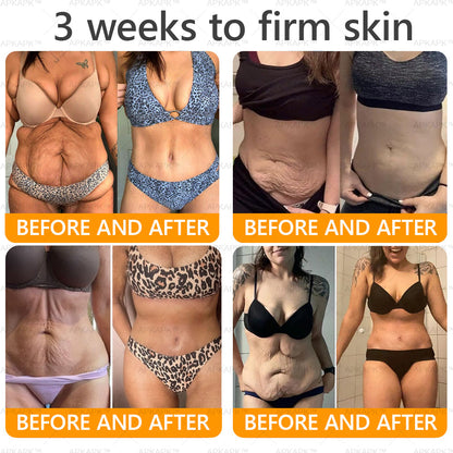 𝐀𝐏𝐊𝐀𝐏® 𝐁𝐞𝐞 𝐯𝐞𝐧𝐨𝐦 𝐒𝐤𝐢𝐧 𝐑𝐞𝐬𝐭𝐨𝐫𝐚𝐭𝐢𝐨𝐧 𝐂𝐫𝐞𝐚𝐦|𝐋𝐀𝐒𝐓 𝐃𝐀𝐘 𝟖𝟎% 𝐎𝐅𝐅💎💎 𝑃𝑜𝑤𝑒𝑟𝑓𝑢𝑙 𝑎𝑛𝑡𝑖-𝑎𝑔𝑖𝑛𝑔 𝑠𝑜𝑙𝑢𝑡𝑖𝑜𝑛 𝑡ℎ𝑎𝑡 𝑡𝑎𝑟𝑔𝑒𝑡𝑠 𝑑𝑒𝑒𝑝 𝑤𝑟𝑖𝑛𝑘𝑙𝑒𝑠, 𝑓𝑖𝑛𝑒 𝑙𝑖𝑛𝑒𝑠, 𝑠𝑎𝑔𝑔𝑖𝑛𝑔 𝑠𝑘𝑖𝑛, 𝑎𝑛𝑑 𝑑𝑟𝑦𝑛𝑒𝑠𝑠