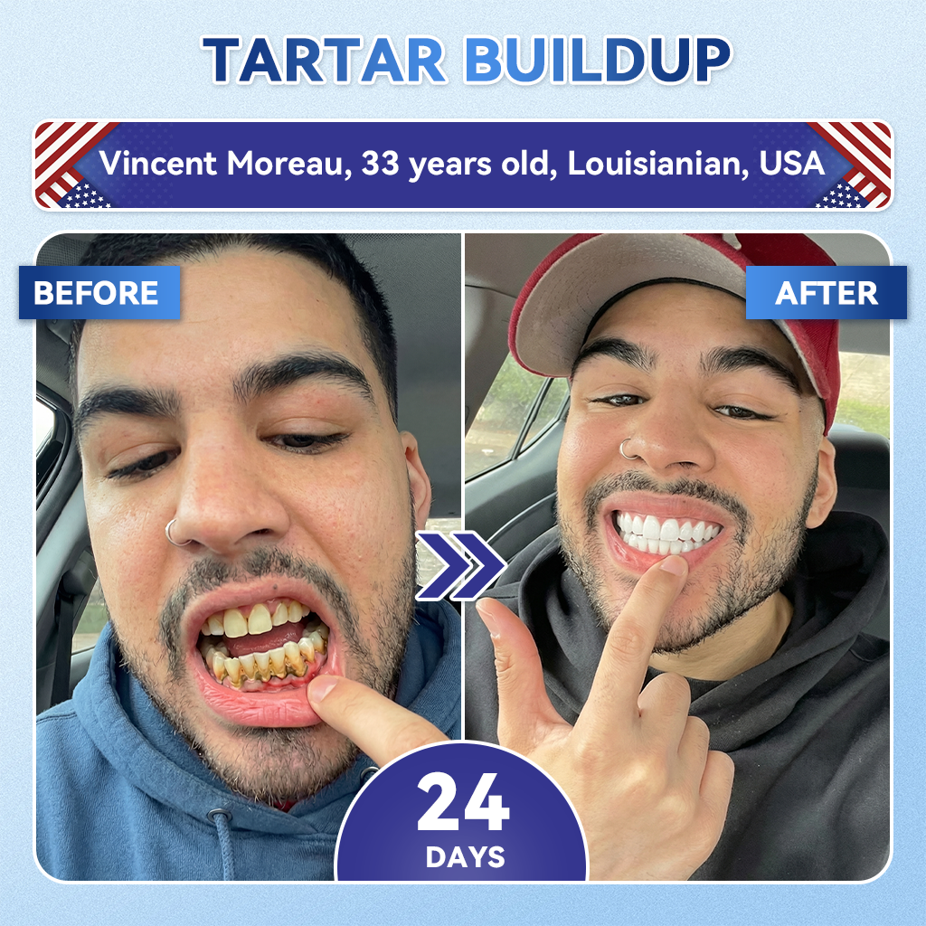 Tideglusib Tooth & Gum Repair Fast‑Dissolving Oral Strips