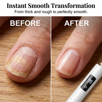 Professional Electric Nail Polisher – Smooths thick nails