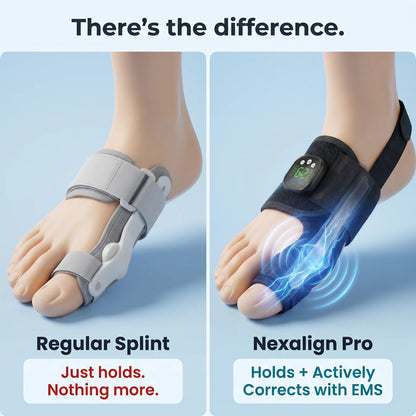 EMS Bunion Corrector, Electric Foot Massager for Hallux Valgus Relief