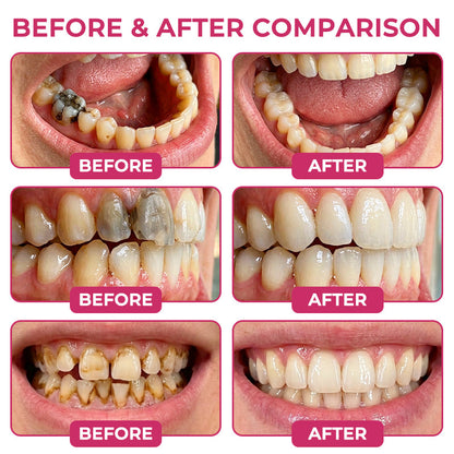 Natural enamel restoration gel for cavity repair