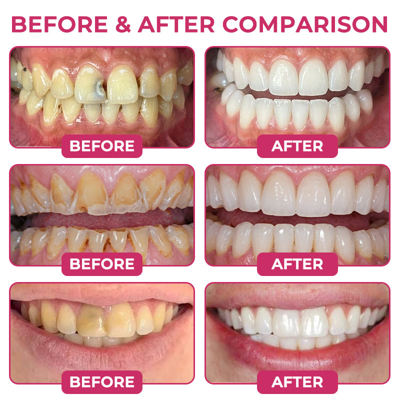 Natural enamel restoration gel for cavity repair
