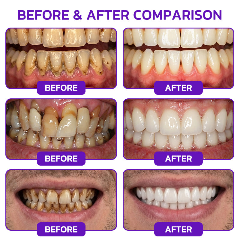 🦷 Bee Venom Toothpaste for Gingivitis & Periodontitis Care