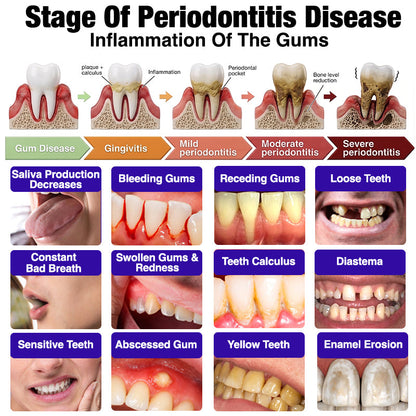 🦷 Bee Venom Toothpaste for Gingivitis & Periodontitis Care