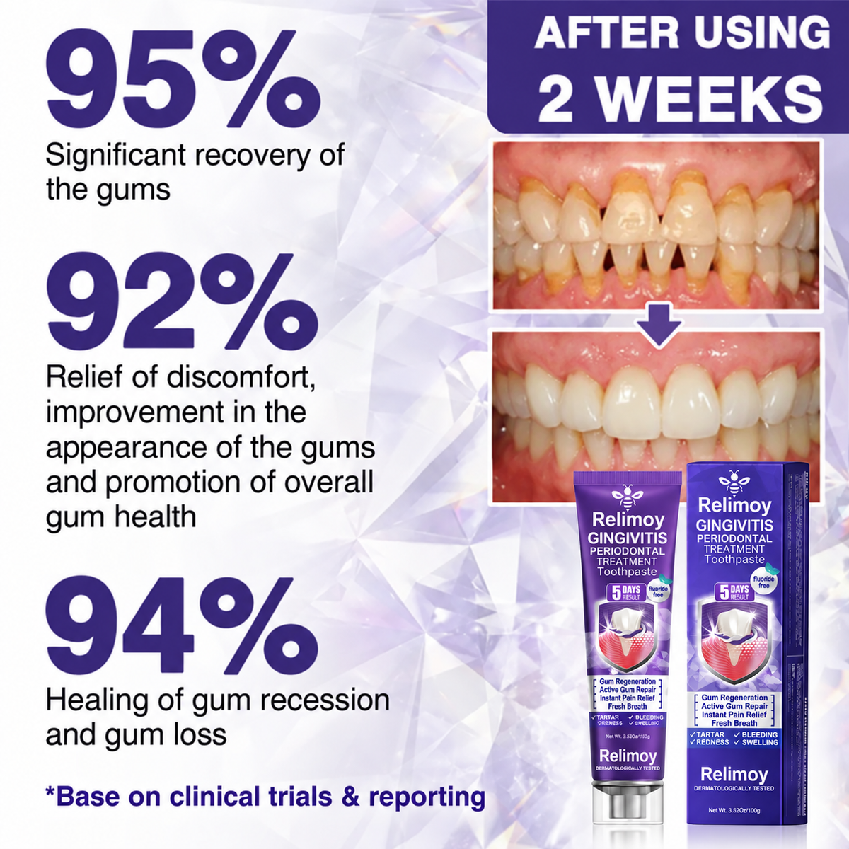🦷 Bee Venom Toothpaste for Gingivitis & Periodontitis Care
