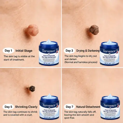 7-Day Skin Tag & Spot Care Cream