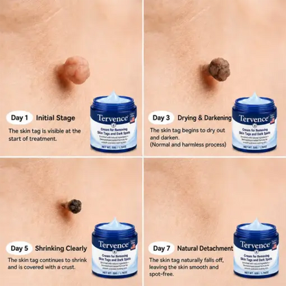 7-Day Skin Tag & Spot Care Cream