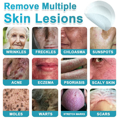 2-in-1 Microneedle & Hydrocolloid Patch👨‍⚕️ | Removes raised moles, acne, flat warts, and skin tags