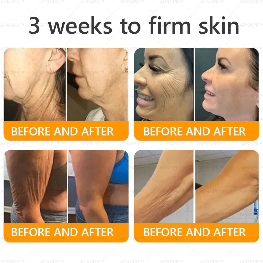 𝐋𝐀𝐒𝐓 𝐃𝐀𝐘 𝟖𝟎% 𝐎𝐅𝐅💎💎 Bee Venom Firm & Revive Cream