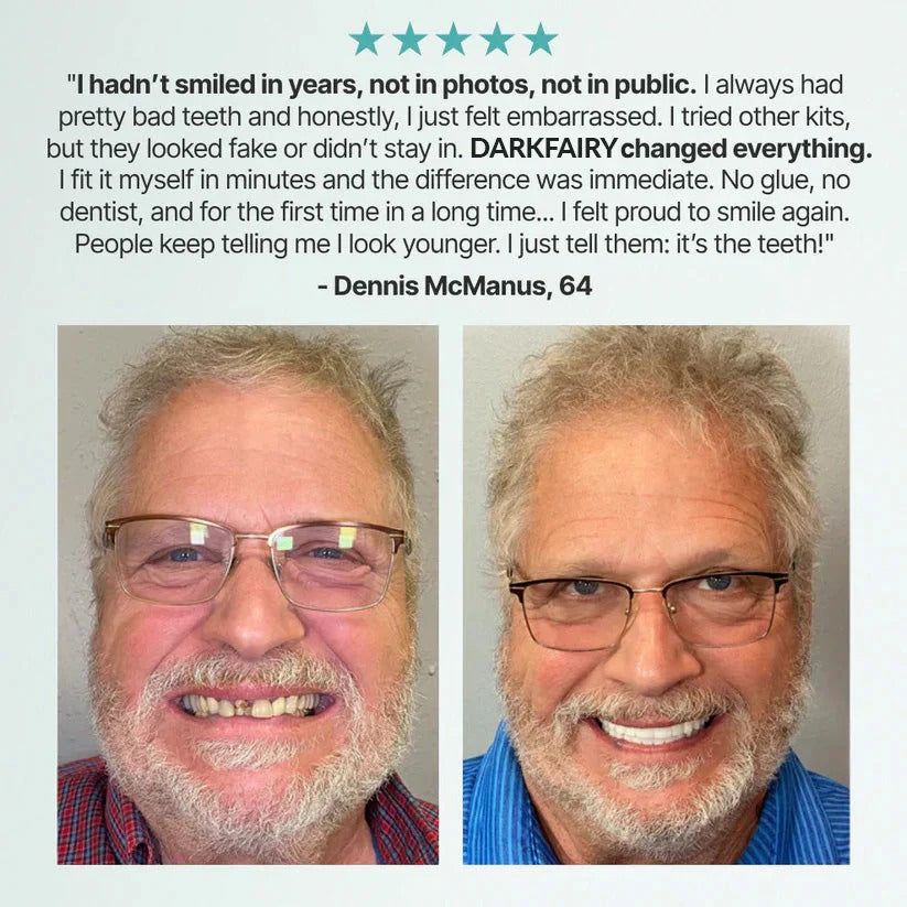 Custom-Fit Dentures — Designed for Comfort and a Natural-Looking Smile