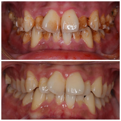 Nature Oral Care Toothpaste | Gentle Gum Care, Prevent Tooth Loss, Long-Lasting Fresh Breath