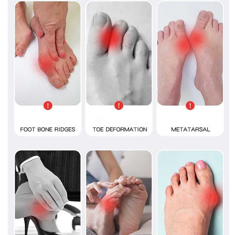 EMS Bunion Corrector, Electric Foot Massager for Hallux Valgus Relief