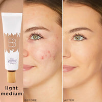 Light-medium