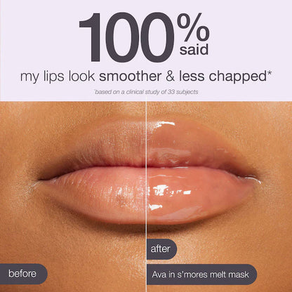 🎅HOT SALE🎀2025 Petite Kisses Lip Duo